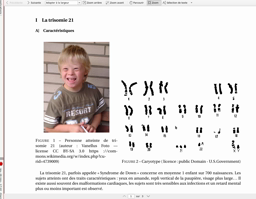 Anomalies méiose