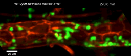 Diapédèse des leucocytes