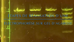 Protocole electrophorèse minione